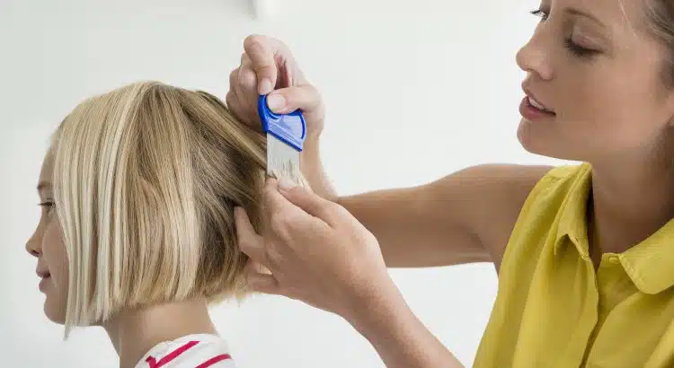 se débarrasser des lentes naturellement